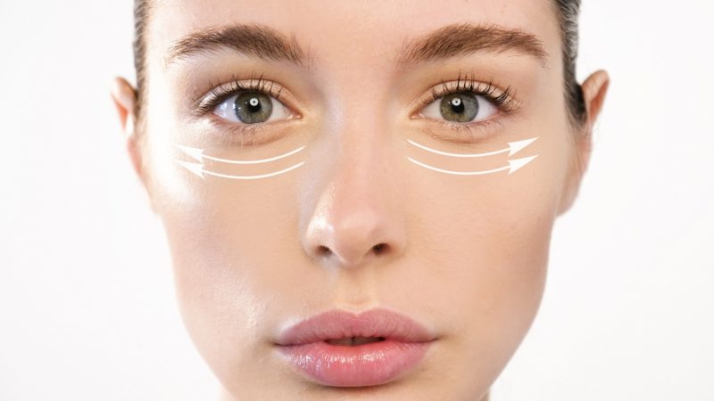 Non-surgical Eye Bag Removal Singapore: How long does Non-surgical Eye Bag Removal Last?