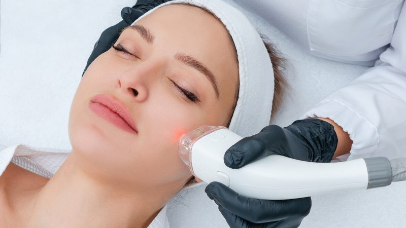 3 Major Things To Know About The Pico Laser Treatment
