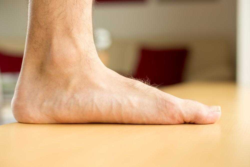 7 Common Causes And Risk Factors Of Flat Feet