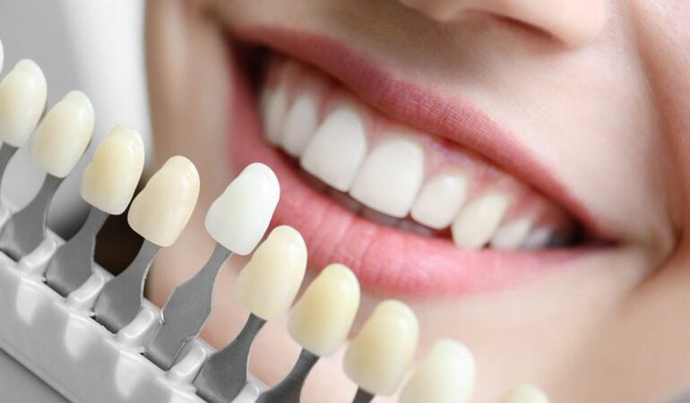 The Importance of Cosmetic Dentistry Procedures