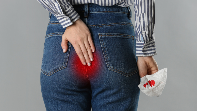 Gastrointestinal Bleeding: All You Need to Know About Blood in the Stools