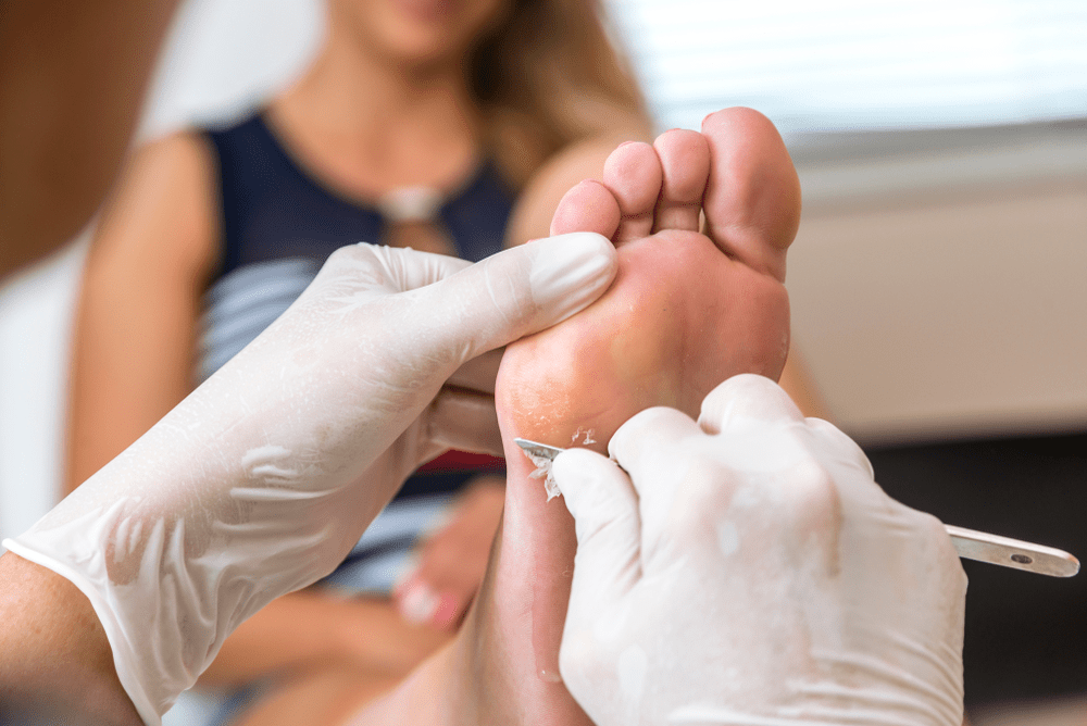 How to Get Relief from Bunion Pain and When to Consider Surgery