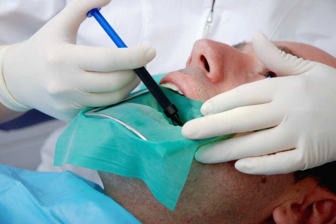 5 Types of Endodontic Procedures