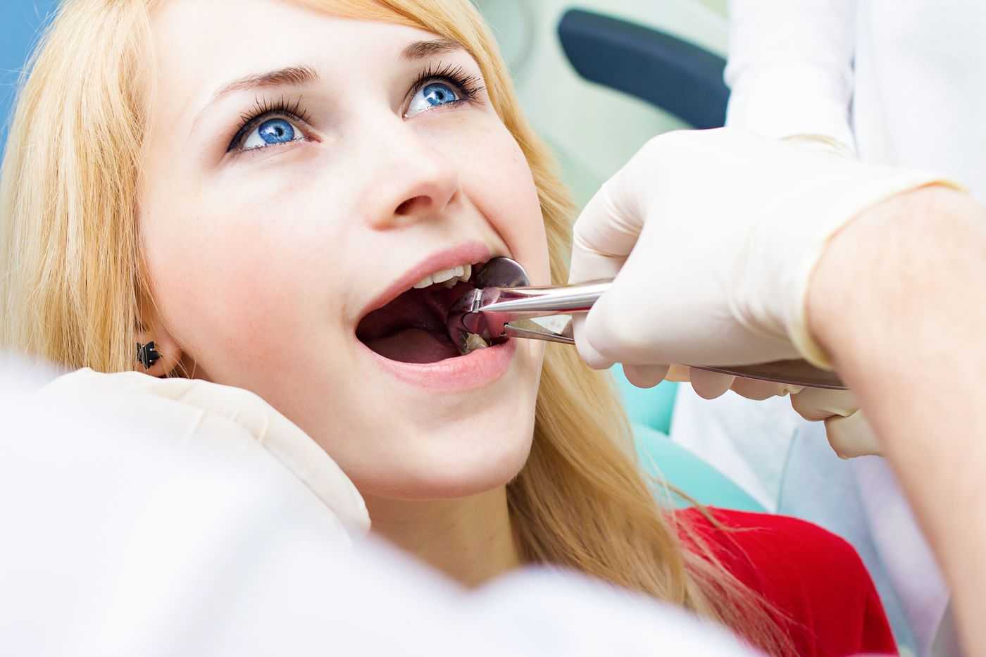 Outstanding Benefits of Having Tooth Extractions