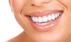 Types of Aesthetic Dental Fillings