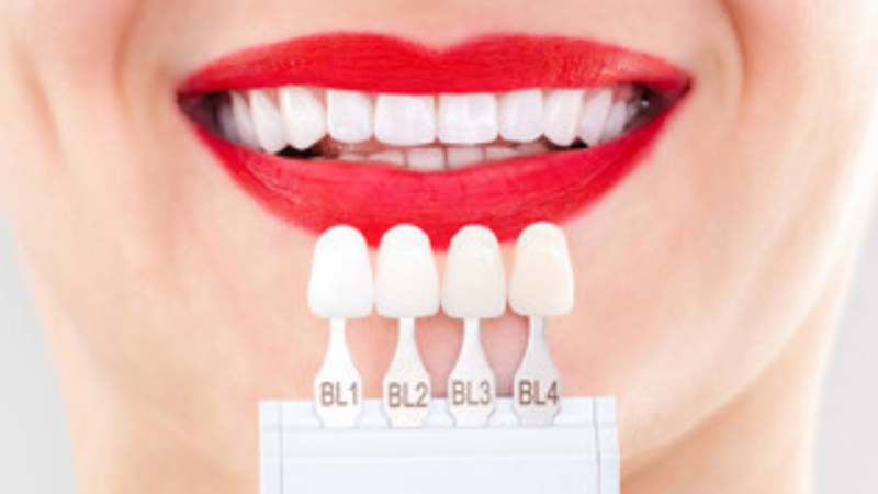 Common Misconceptions About Cosmetic Dentistry Debunked