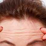 Banishing Wrinkles