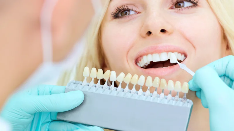 Teeth whitening – all you need to know
