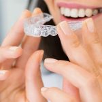 Teeth Alignment