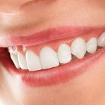 Healthy Smile