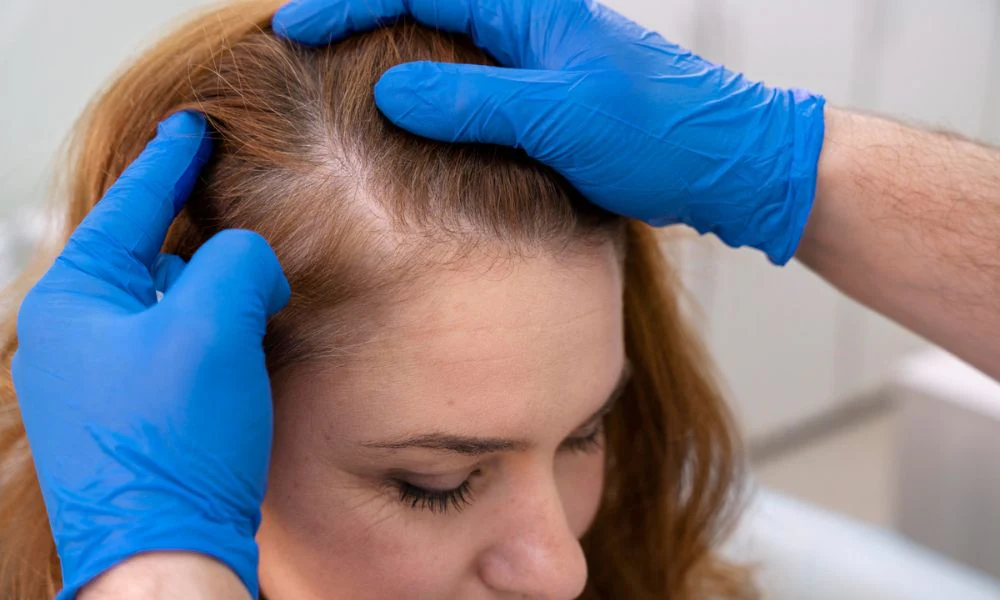 Unlocking the Secret World of Your Scalp Microbiome for Unstoppable Hair Growth
