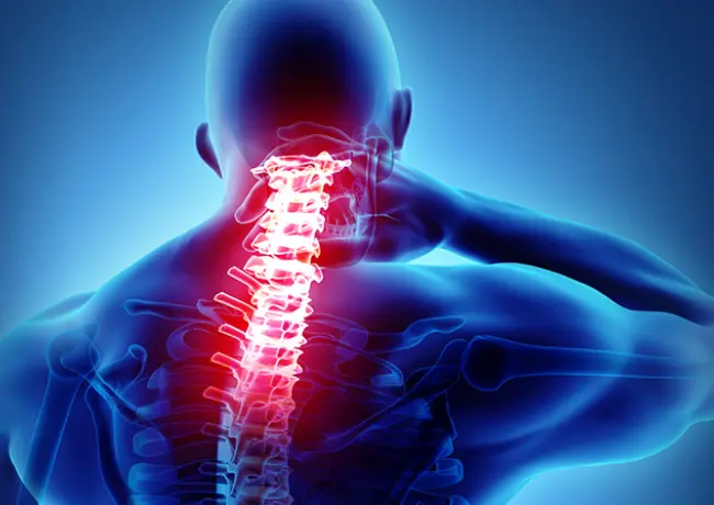 Neck and Back Pain Affects a Significant Portion of Merced Residents
