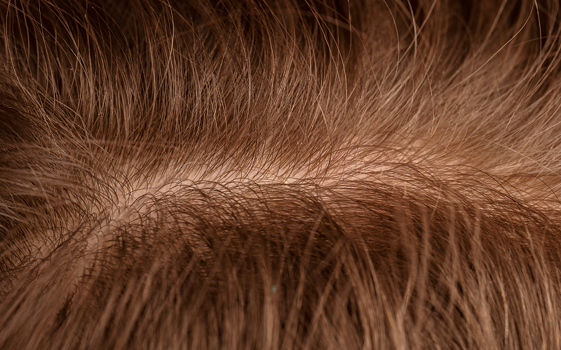 8 Beginner and Practical Steps for Itchy Scalp in Singapore