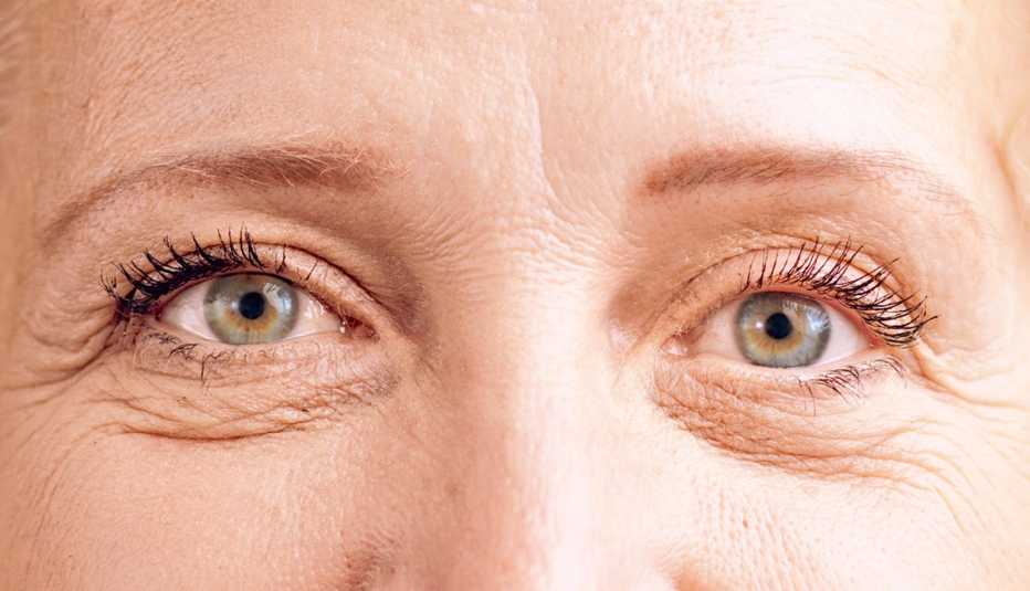 Can Weak Eyelids Be Treated Without Surgery