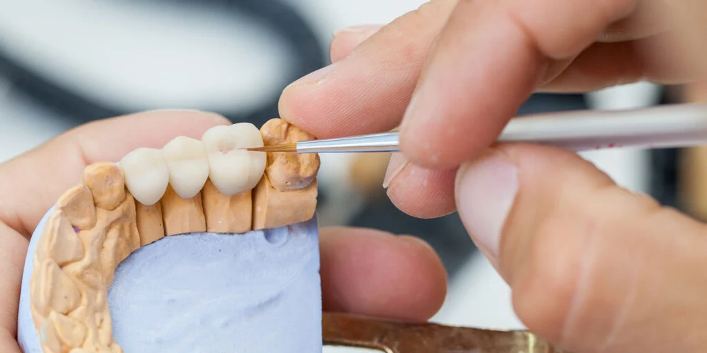 Same-Day Dental Crowns in Burley, ID: How CEREC Technology Is Changing the Way Mini-Cassia Families Restore Their Smiles