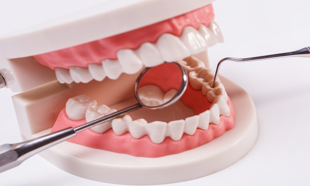How Advances in Biomaterials Are Redefining the Success Rate of Dental Implants