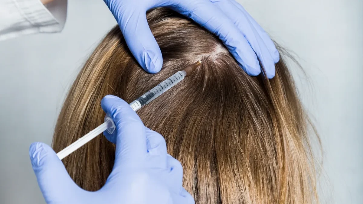 PRP Therapy for Hair Loss: How It Works and What the Science Says