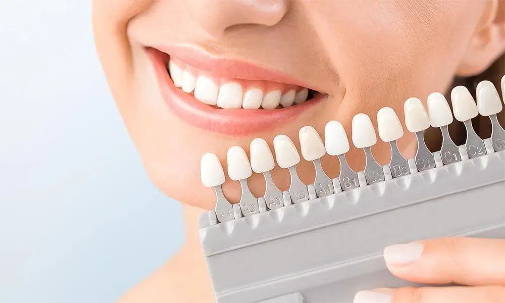 Ceramic or Composite Veneers: Understanding the Key Differences