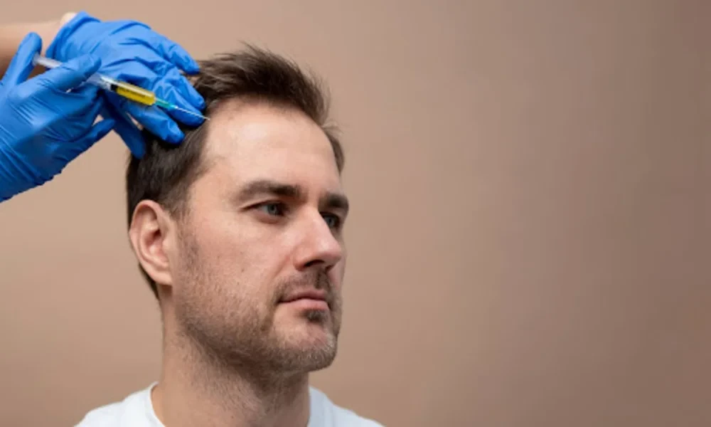 Hair Transplant Expectations: Exploring Growth, Coverage, And Density