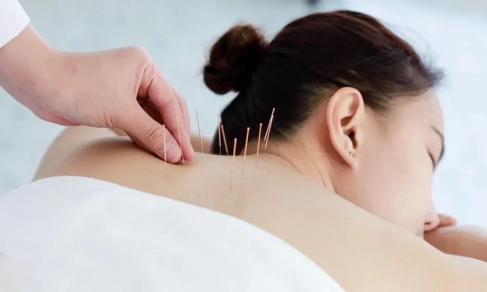 How a Singapore Clinic Tailors TCM to Your Body Type